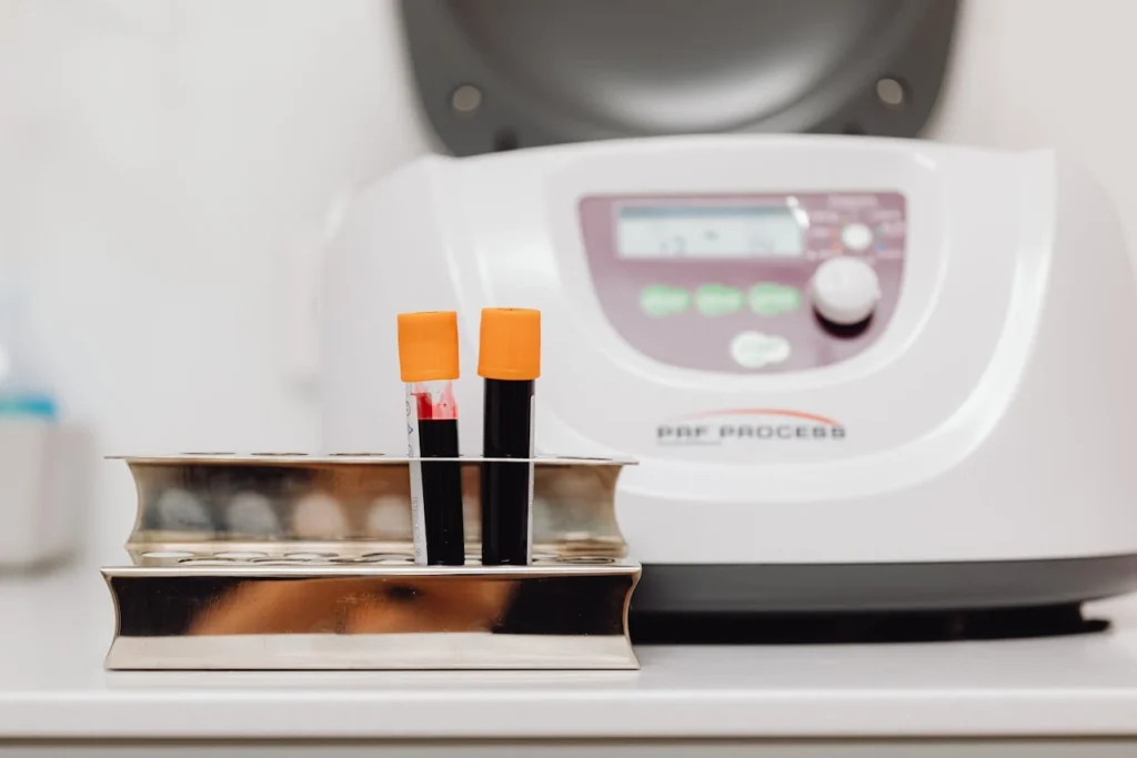 Hormone Blood Tests