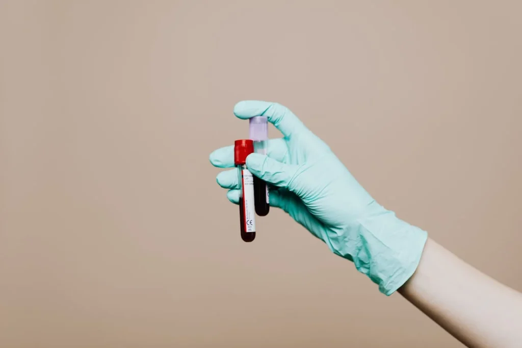 Testosterone Blood Test