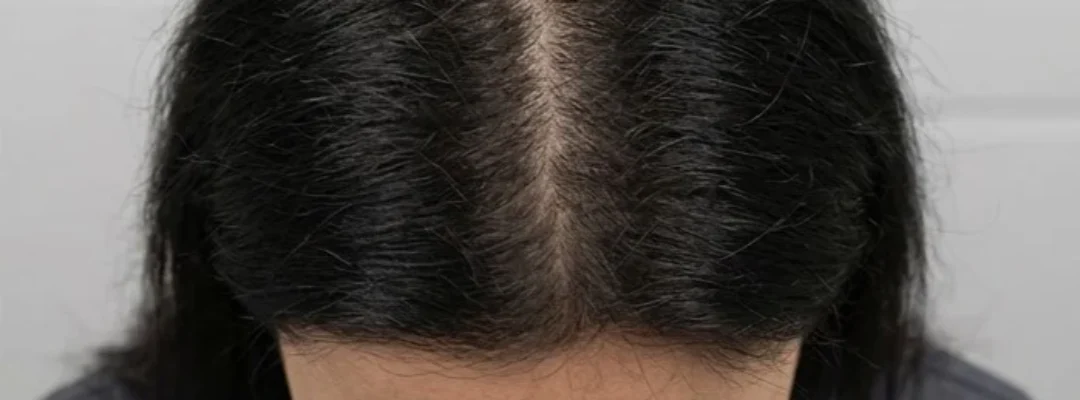 Polynucleotides Hair After Treatment