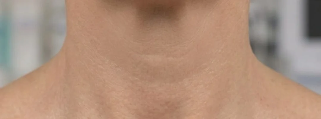 Polynucleotides Neck After Treatment
